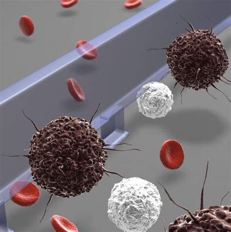 Rapid Microfluidic Sorting for Rare Cancer Cell Detection 