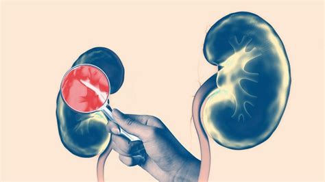 These 5 Conditions Can Damage Your Kidneys, and 2 of Them Are Extremely ...