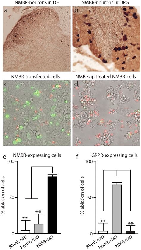 A Nociceptive Signaling Role For Neuromedin B Journal Of Neuroscience