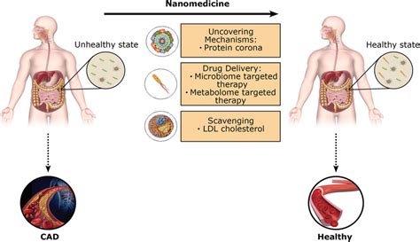 Nanomedicine Microbiota And Cad Nanoparticles In Nanomedicine Have