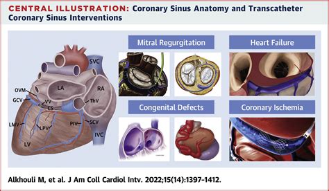 Transcatheter Coronary Sinus Interventions Jacc Cardiovascular