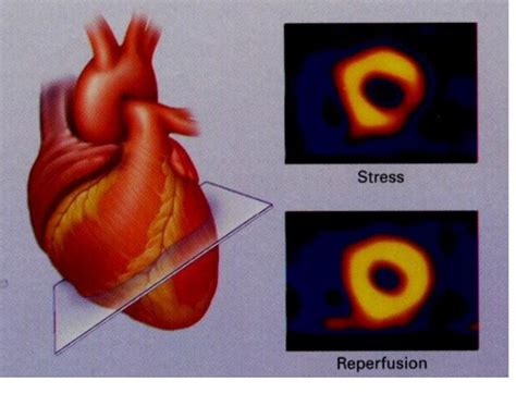 MEDI Noninvasive Cardiac Imaging Flashcards Quizlet