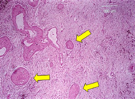 Sm Of Deep Tubular Structures Of The Appendix Testis He Original Download Scientific Diagram