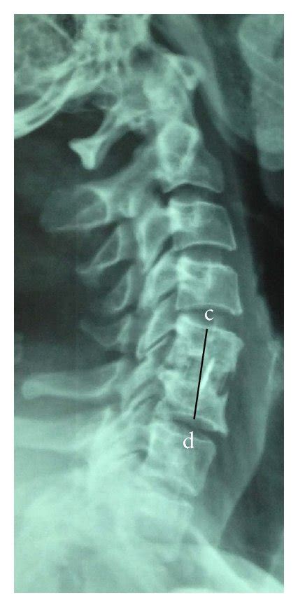 Radiographies Are Related To A 42 Year Old Female Patient That Download Scientific Diagram