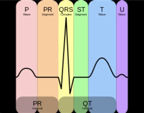 Ecg Flashcards Quizlet