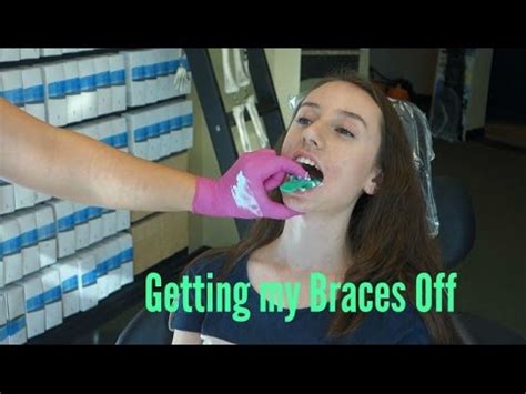 Getting My Braces Off Vlog Youtube