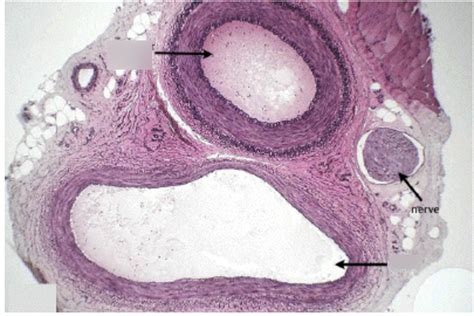 Artery And Vein Histology Labeling Diagram Quizlet