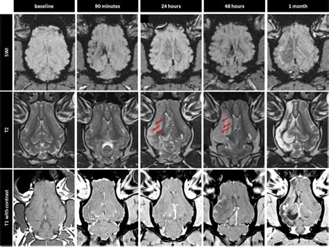 Longitudinal Mr Imaging Of Representative Animal Showing Evolution Of