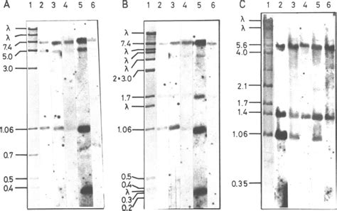 Blot Hybridization With Labelled Rna Blots Identical To Those Shown In