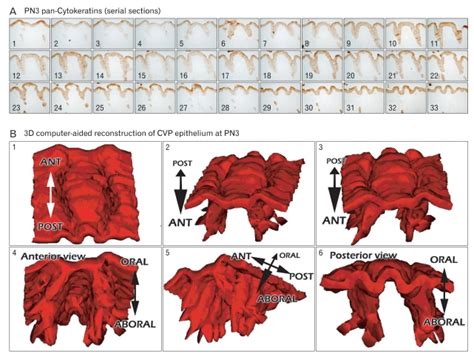 Three Dimensional D Computer Aided Reconstruction After