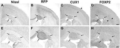 Figure From Embryonic Disruption Of The Candidate Dyslexia