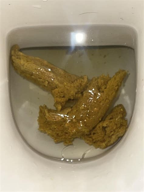 Is it Crohn stool? : r/poop