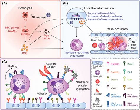 Current Paradigm Of Vaso‐occlusion In Sickle Cell Disease A