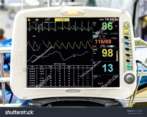 Ekg Monitor Stock Photo 221336788 | Shutterstock