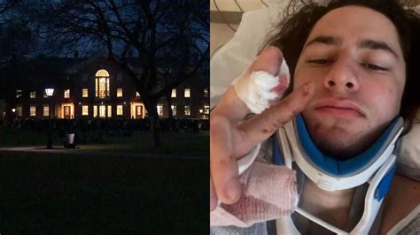 Brown students hold vigil after classmate injured in Vermont shooting