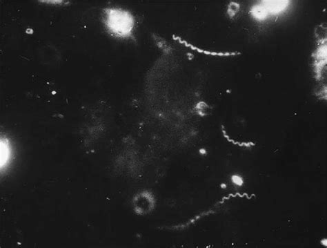 This dark field microscopy of the immune fluorescence staining ...