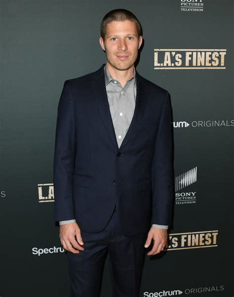 Zach Gilford Shares Shocking Photos of Face After Health Scare | Us Weekly