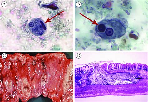 Entamoeba Histolytica Trichrome Stain