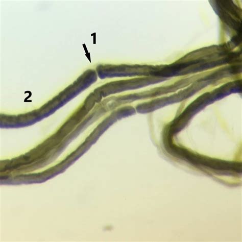 Showing Normal Architecture Sciatic Nerve Of Rat Node Of Ranvier