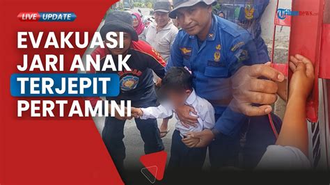 Jari Seorang Anak SD Bener Meriah Terjepit Di Pertamini Satu Jam