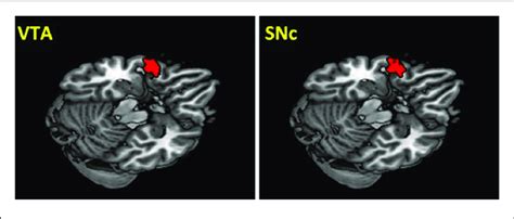 Brain Areas Showing Differences In Rsfc Between Genders Connectivity Download Scientific