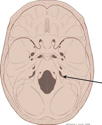 Holes In The Skull And Stuff That Goes Through Them Flashcards Quizlet