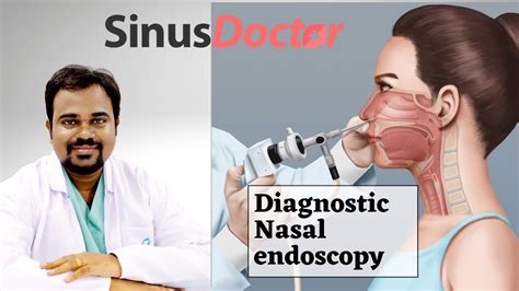 What Is A Nasal Endoscopy Procedure Indications Side 44 OFF