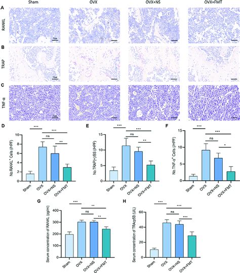 FMT Treatment Suppressed Osteoclastogenesis A RANKL B TRAP And