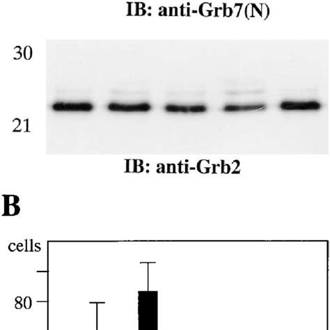 Effect Of Antisense Grb7 Rna Expression On The Phenotype Of Esophageal