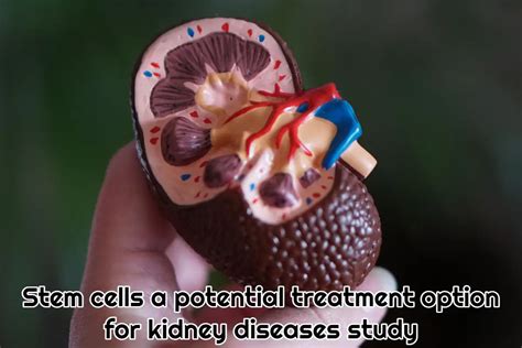 Stem Cells A Potential Treatment Option For Kidney Diseases Study