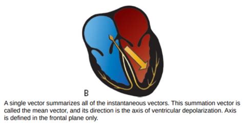 Diagnostic Methods Exam Ekgs Lecture Axis Hypertrophy And