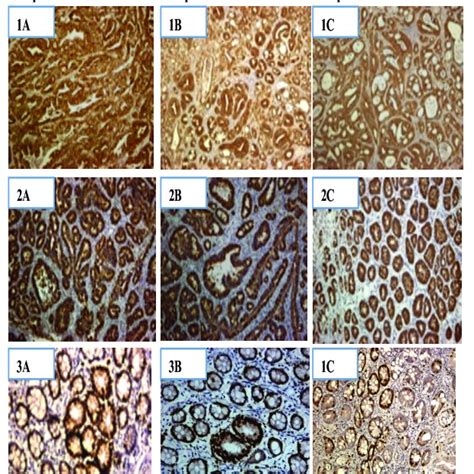 Immunohistochemical Staining Of β Catenin And Cox 2 And Ki 67 In Aom Download Scientific