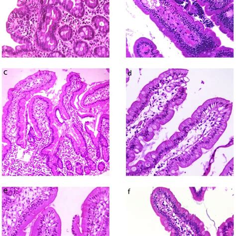 Duodenal Histology From Ibs Like Patients Light Microscopy Lm Download Scientific Diagram