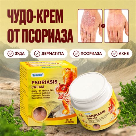 Мазь Крем от ПСОРИАЗА, экземы, атопического дерматита / Китайская чудо ...