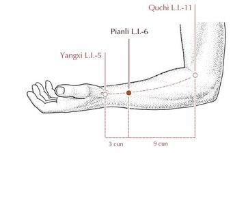 Urticaria Tcm Flashcards Quizlet