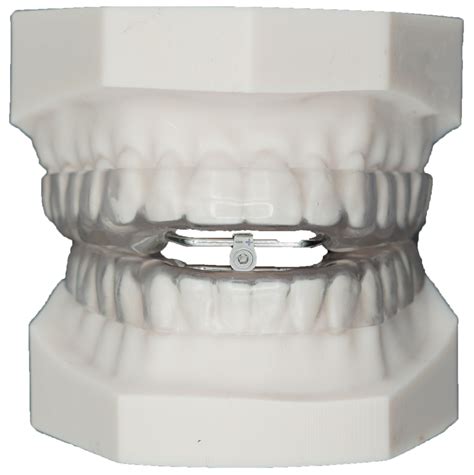 Herbst Sleep Appliance Protec Dental