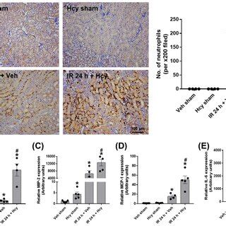 Hcy Exacerbates Renal Ir Induced Tubular Apoptosis In The Kidney The