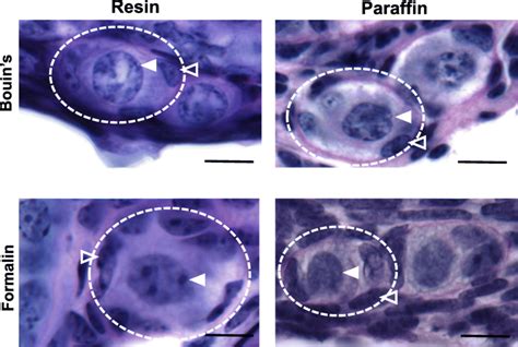 Primordial Follicle Morphology In Ovarian Tissue Prepared Using