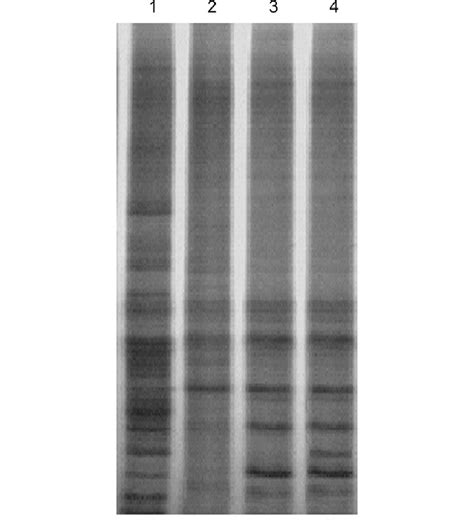 Dgge Band Profiles Of All Bacterial Communities Amplified 16s Rdna