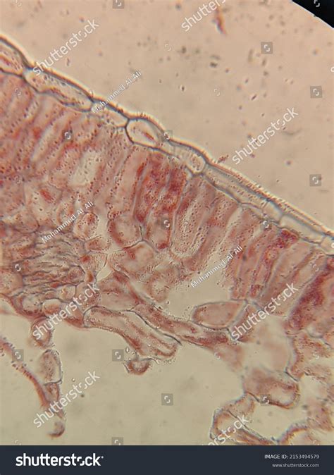 Ootage Demodex Face Mites Under Microscope Stock Photo 2153494579 ...