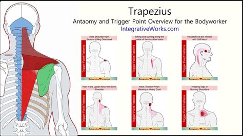 Trapezius - Anatomy and Trigger points | Trigger points, Shoulder ...