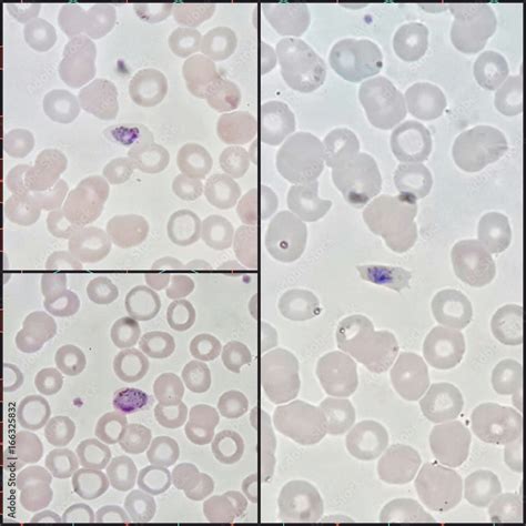 Three Human Parasite Form Patterns Trophozoite Form Of Plasmodium