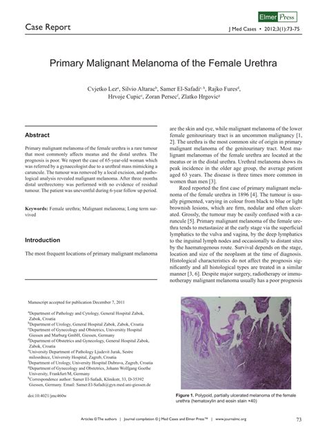 Pdf Primary Malignant Melanoma Of The Female Urethra