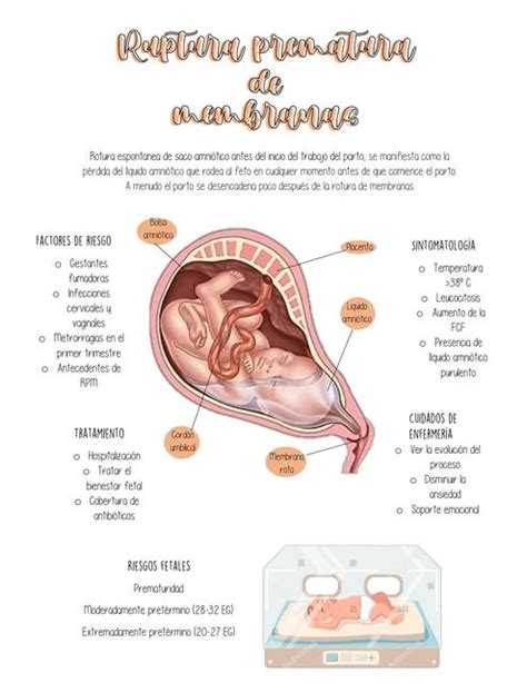 Ruptura Prematura De Membranas Carolina Aldana Udocz