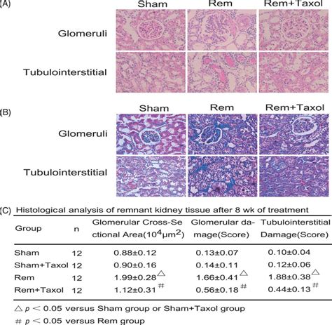 Effect Of Taxol On Renal Morphology Of Rat Remnant Kidney Kidney