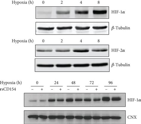 Induction Of Hif 1α And Hif 2α And Endoplasmic Reticulum Stress In Hk 2