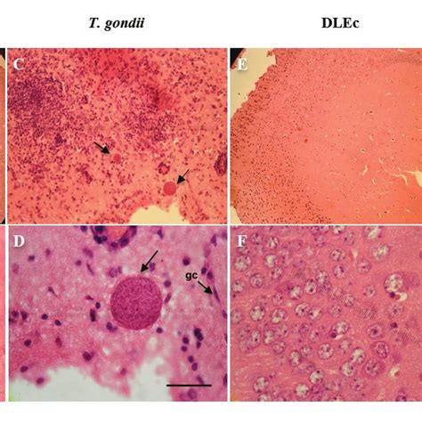 histopathology in the brains of healthy mice, mice infected with ... 