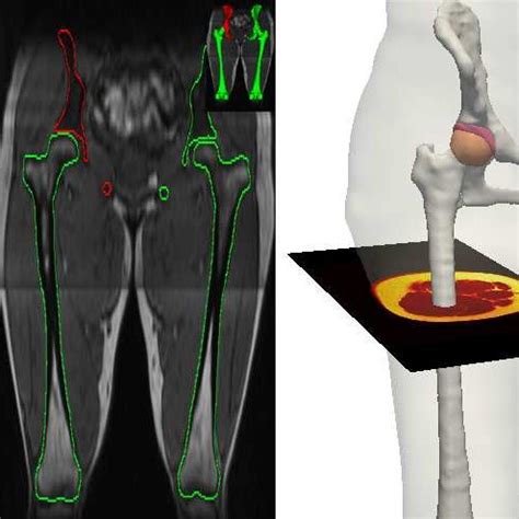 MRI dataset volume used to segment hip joint anatomical structures ...