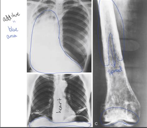 Imaging Pathology Flashcards Quizlet