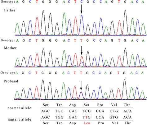 Sanger Sequencing Results Of Identified Ankrd11 Reference Transcript